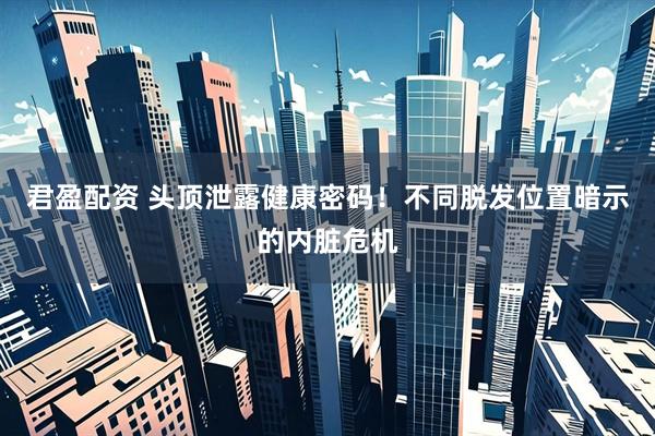 君盈配资 头顶泄露健康密码！不同脱发位置暗示的内脏危机
